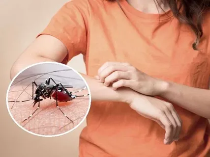 Dengue mosquito attacks in Islamabad, 37 more dengue victims in the last 24 hours