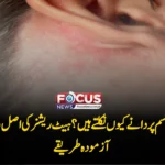 گرمیوں میں جسم پر دانے کیوں نکلتے ہیں؟ ہیٹ ریشز کی اصل وجہ اور بچاؤ کے آزمودہ طریقے