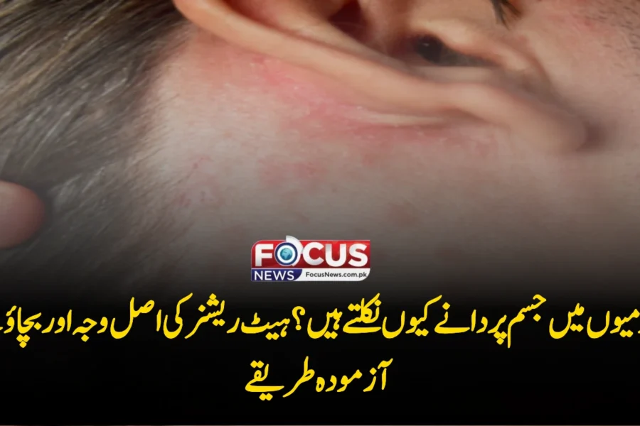 گرمیوں میں جسم پر دانے کیوں نکلتے ہیں؟ ہیٹ ریشز کی اصل وجہ اور بچاؤ کے آزمودہ طریقے