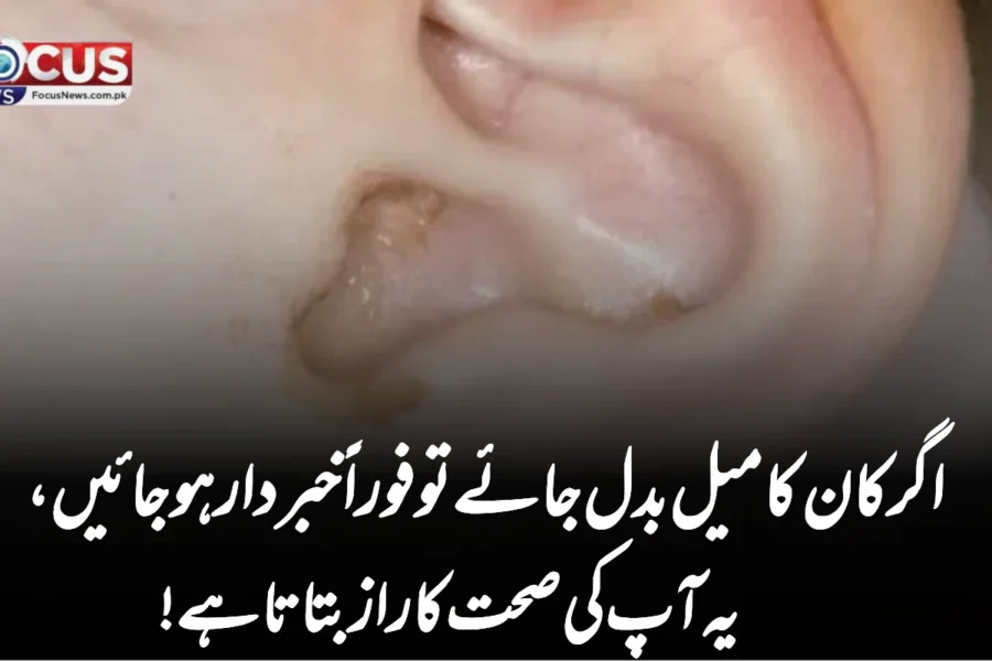 اگر کان کا میل بدل جائے تو فوراً خبردار ہو جائیں، یہ آپ کی صحت کا راز بتاتا ہے!
