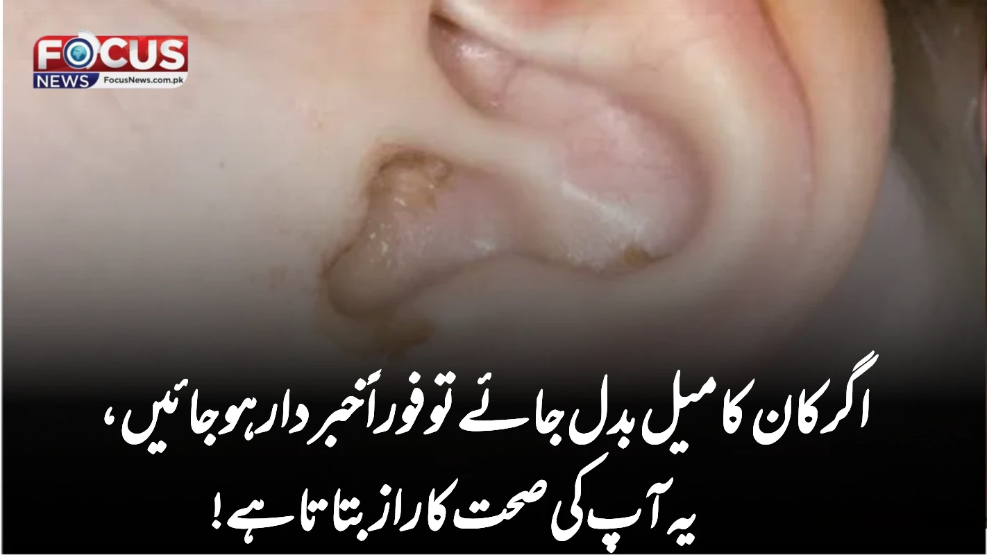 اگر کان کا میل بدل جائے تو فوراً خبردار ہو جائیں، یہ آپ کی صحت کا راز بتاتا ہے!