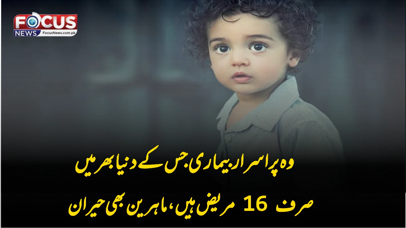 وہ پراسرار بیماری جس کے دنیا بھر میں صرف 16 مریض ہیں، ماہرین بھی حیران